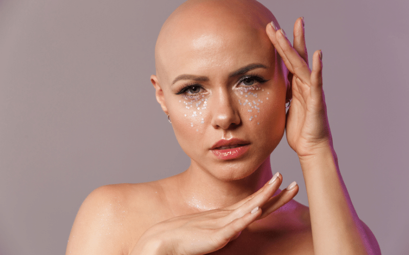 femme calvitie ménopause