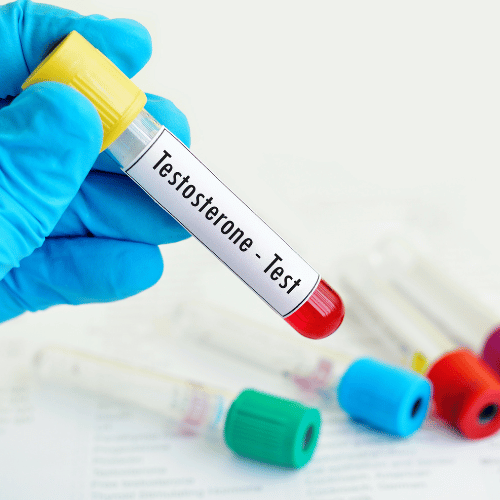 Taux de testostérone et androgènes dans l'hirsutisme féminin