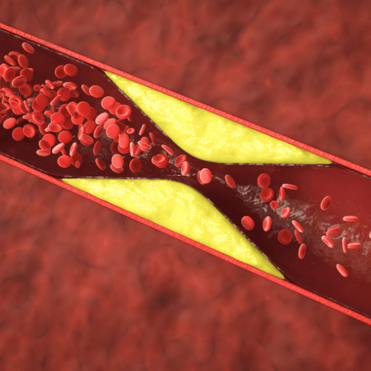risques-accrus-cardiovasculaires - MoonFlow risques accrus cardiovasculaires en cas d'insuffisance ovarienne prématurée